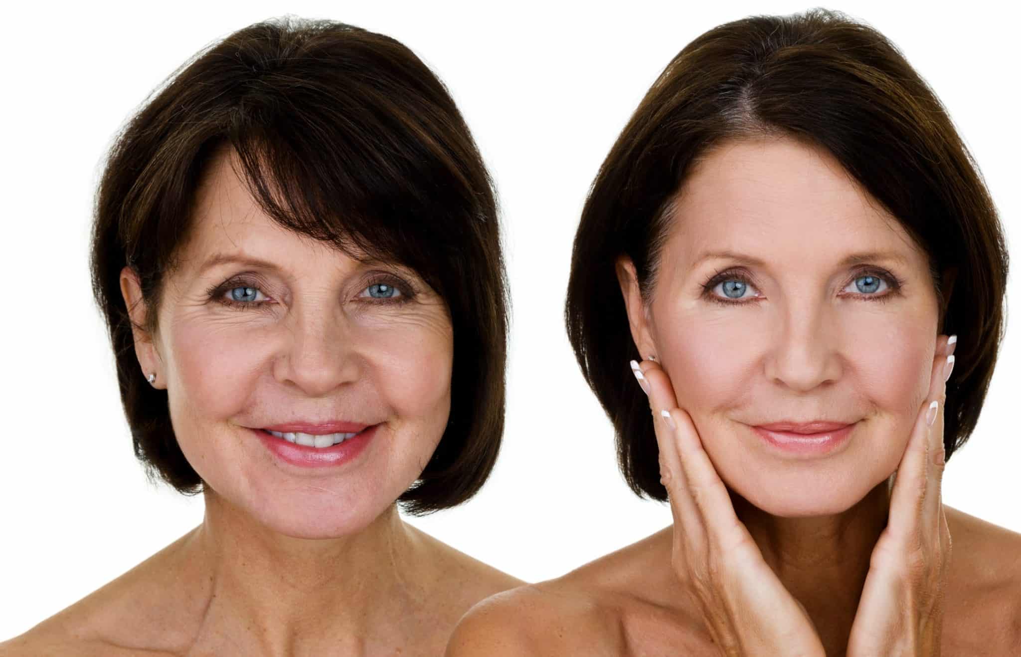 Juvederm Albany OR