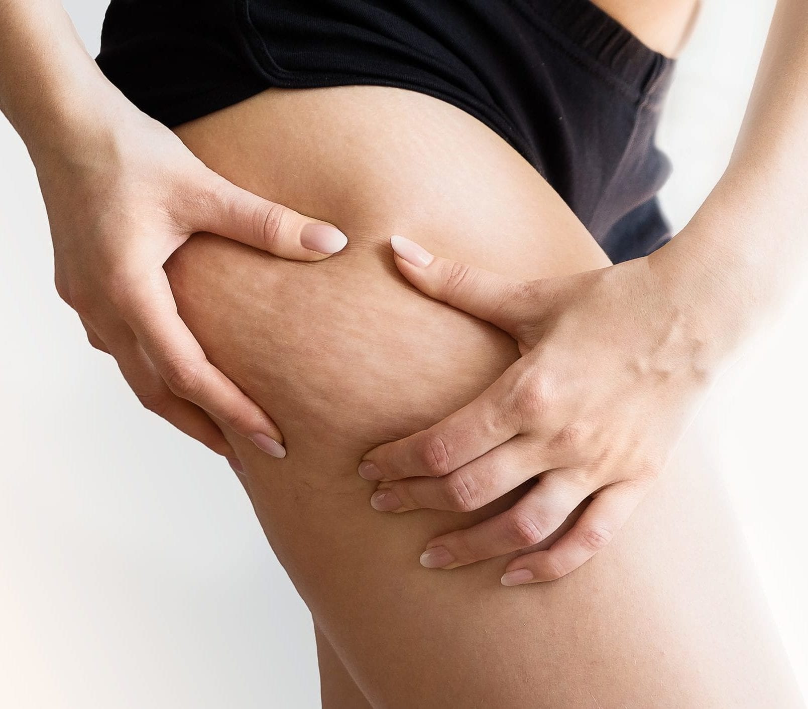 Laser Cellulite Treatment, OR