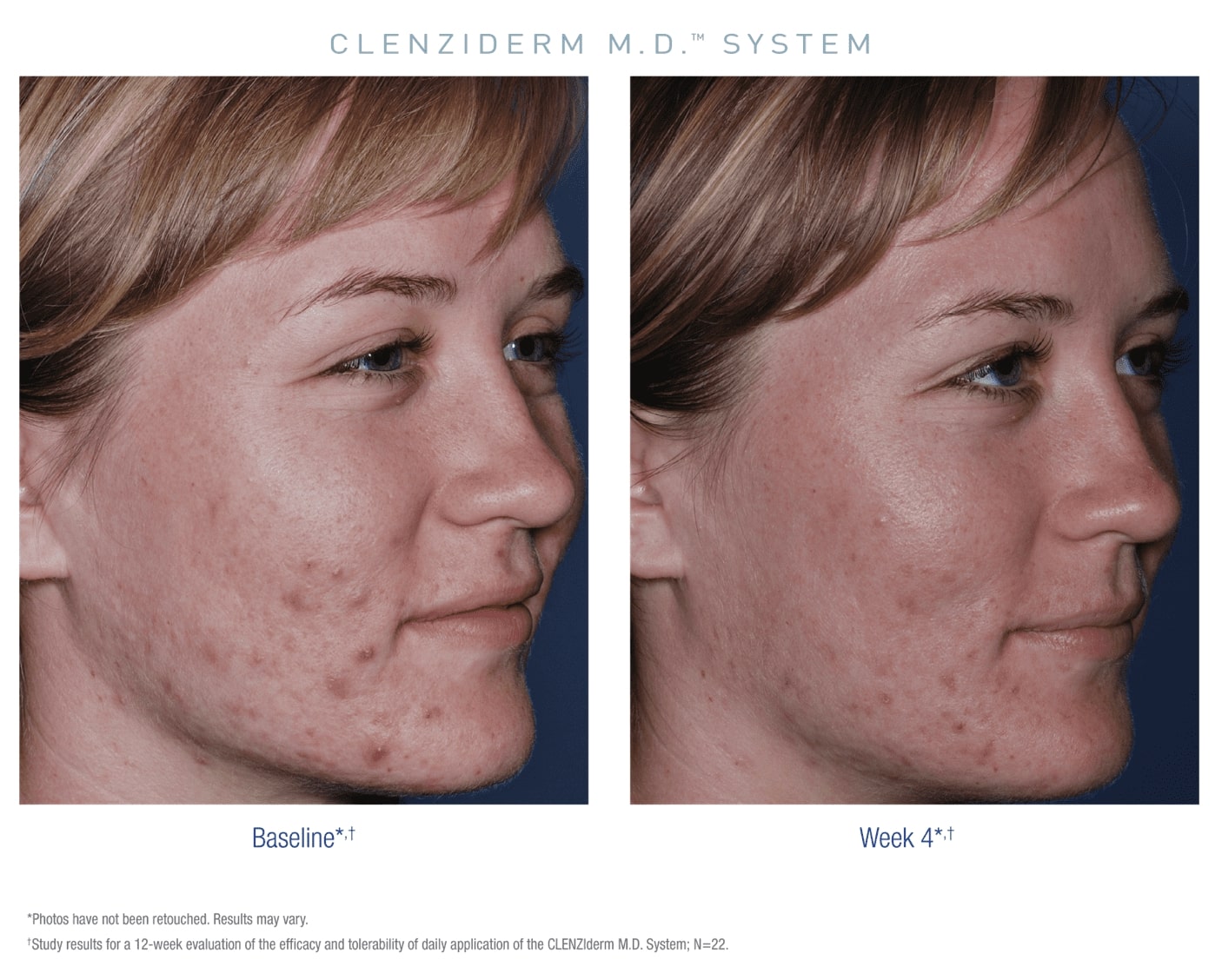 clenzi case 1