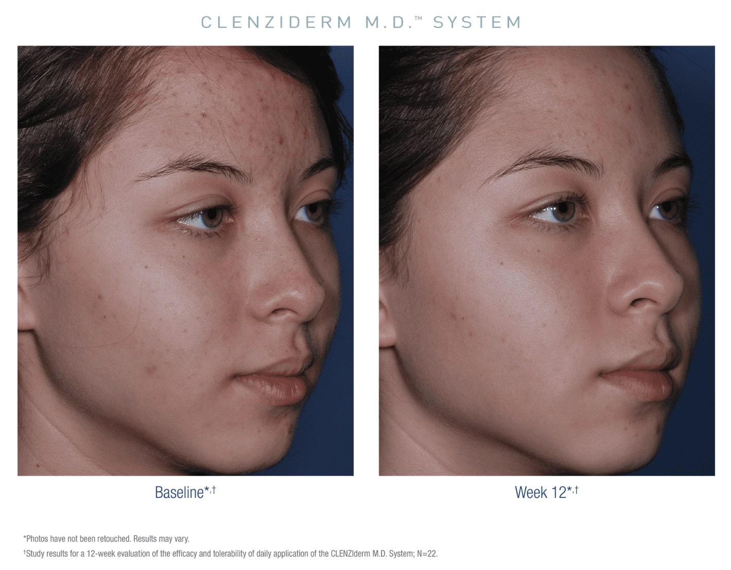 clenzi case 2