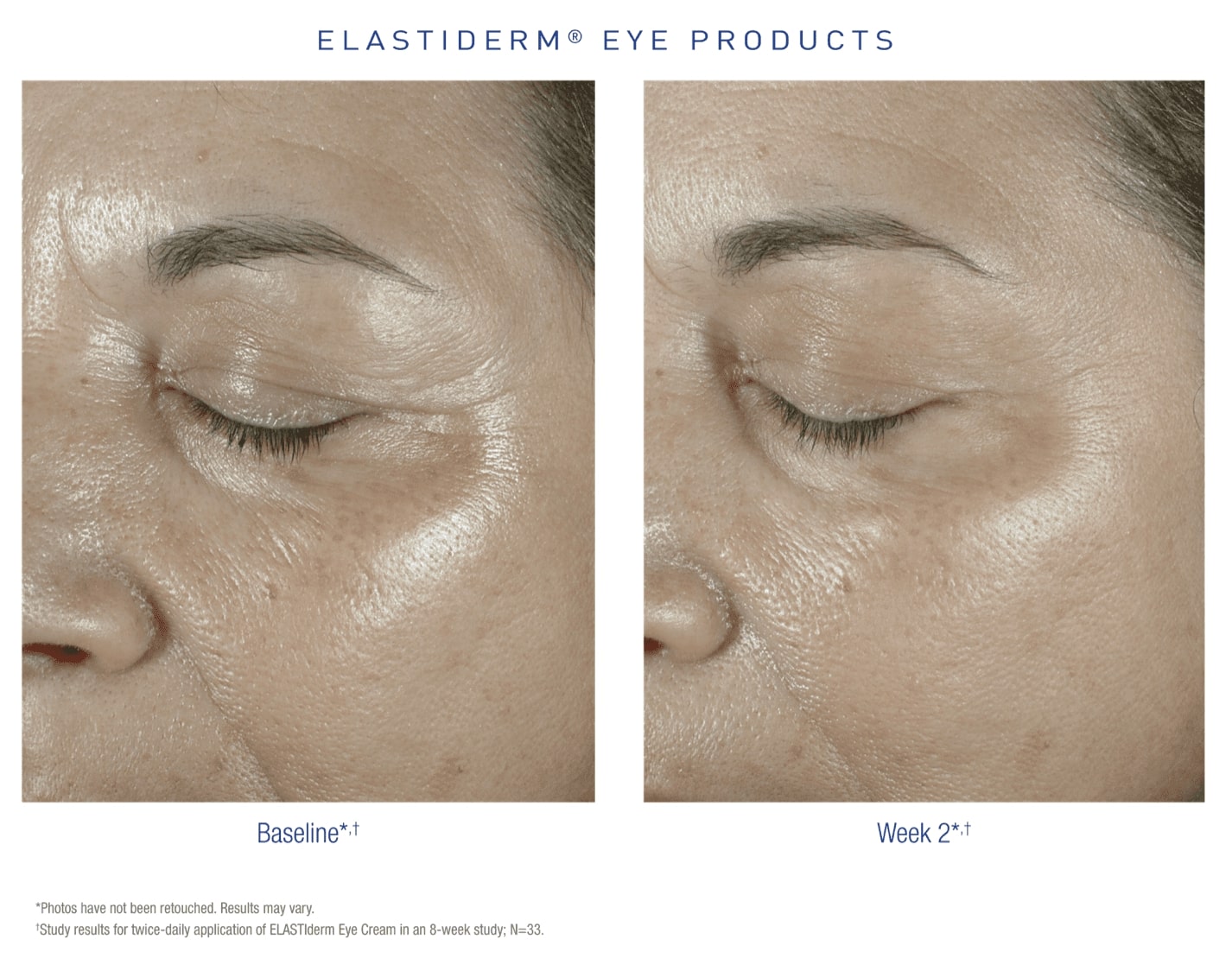 elastiderm case 2
