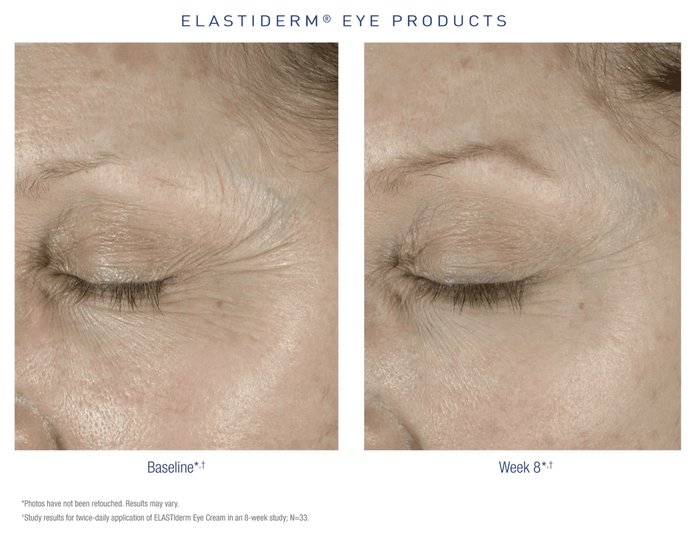 elastiderm case