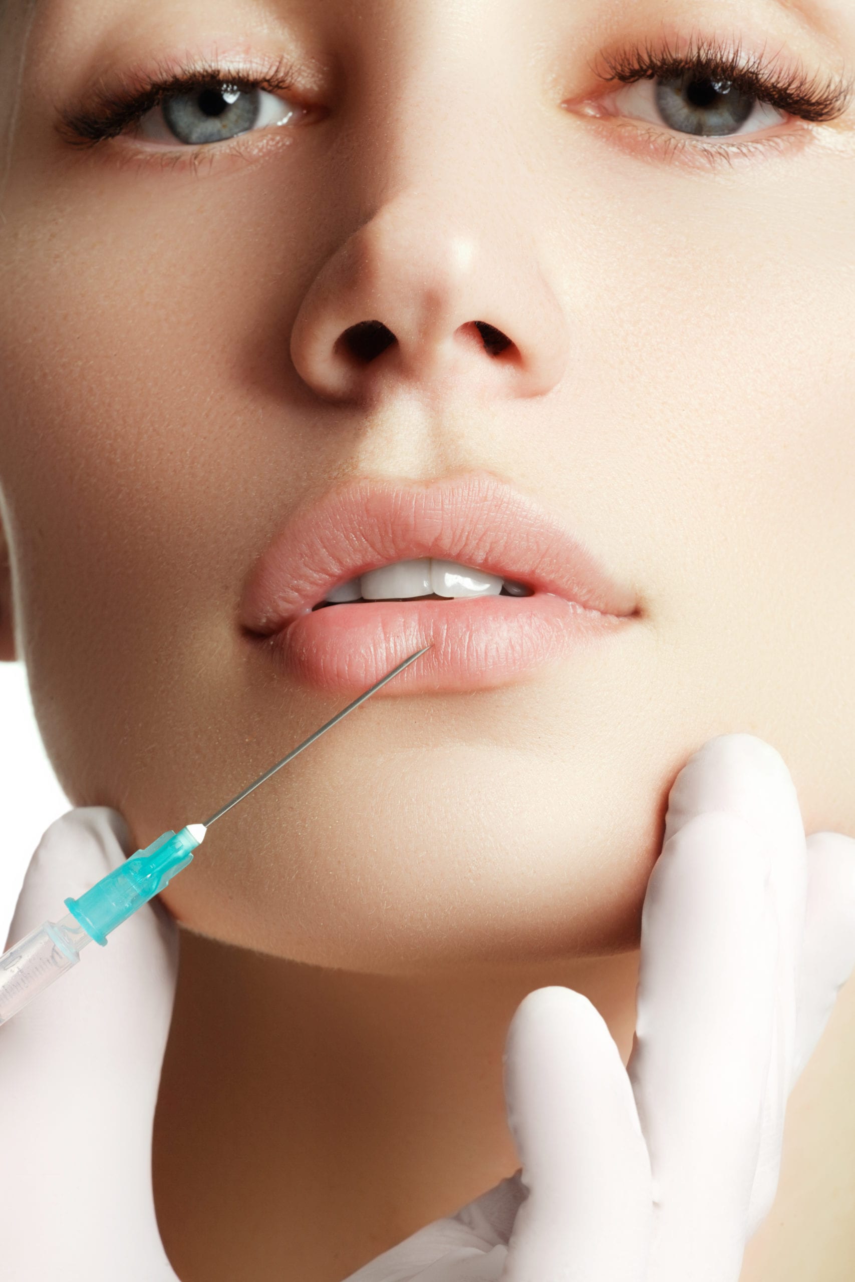 Juvéderm Volbella XC For Lips
