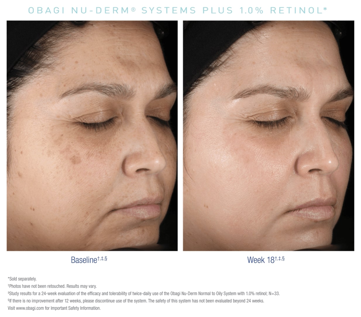 obagi nu derm case 1