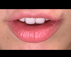 Lip Flip